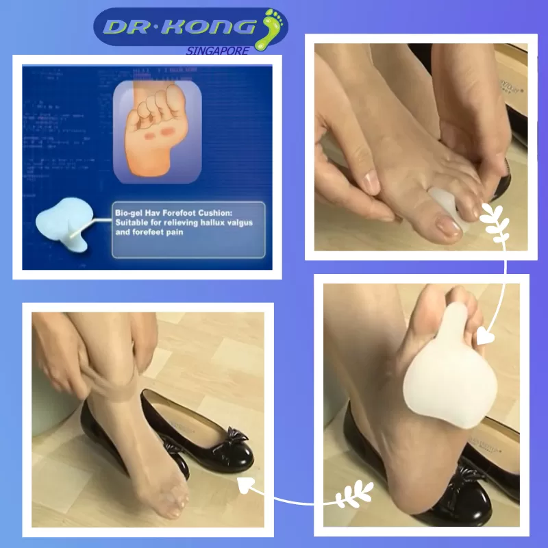 DR.KONG BIO-GEL FOREFOOT CUSHION (HAV) ACCESSORIES DK-DKA31-F(RP : $16.90)